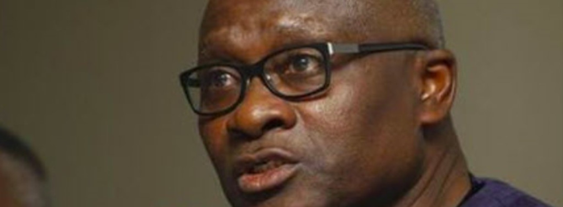 No CSM death in Lagos – Health Commissioner