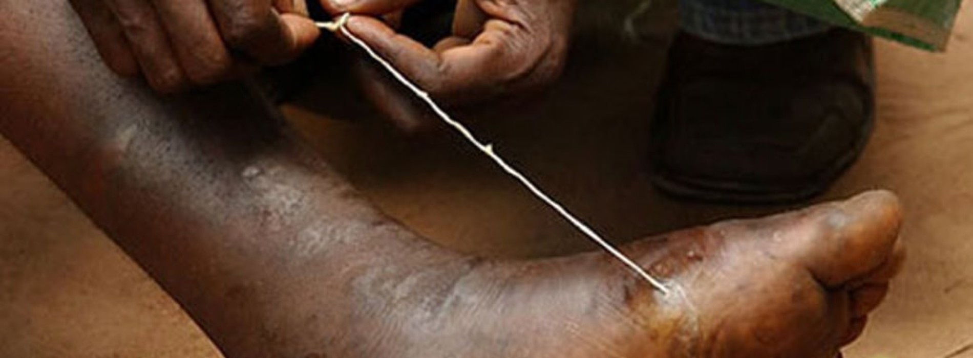 Guinea worm disease: Going, Going …