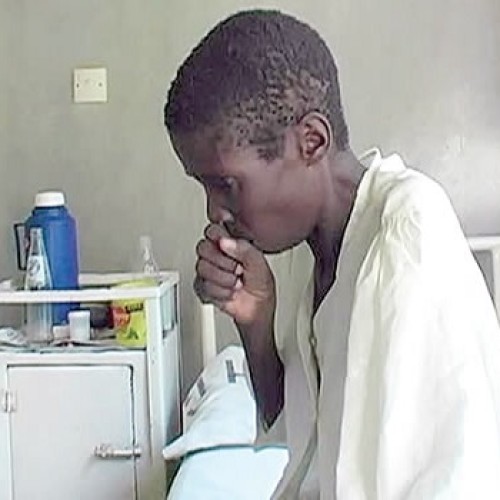 COVID-19: TB incidence on increase – Report  