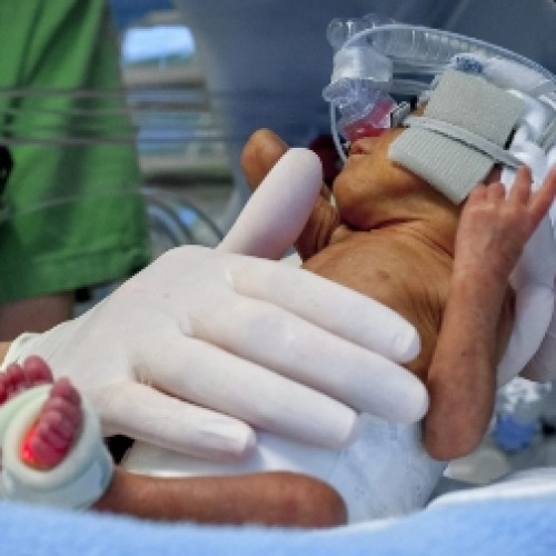 Brain-dead Polish woman gives birth to baby boy