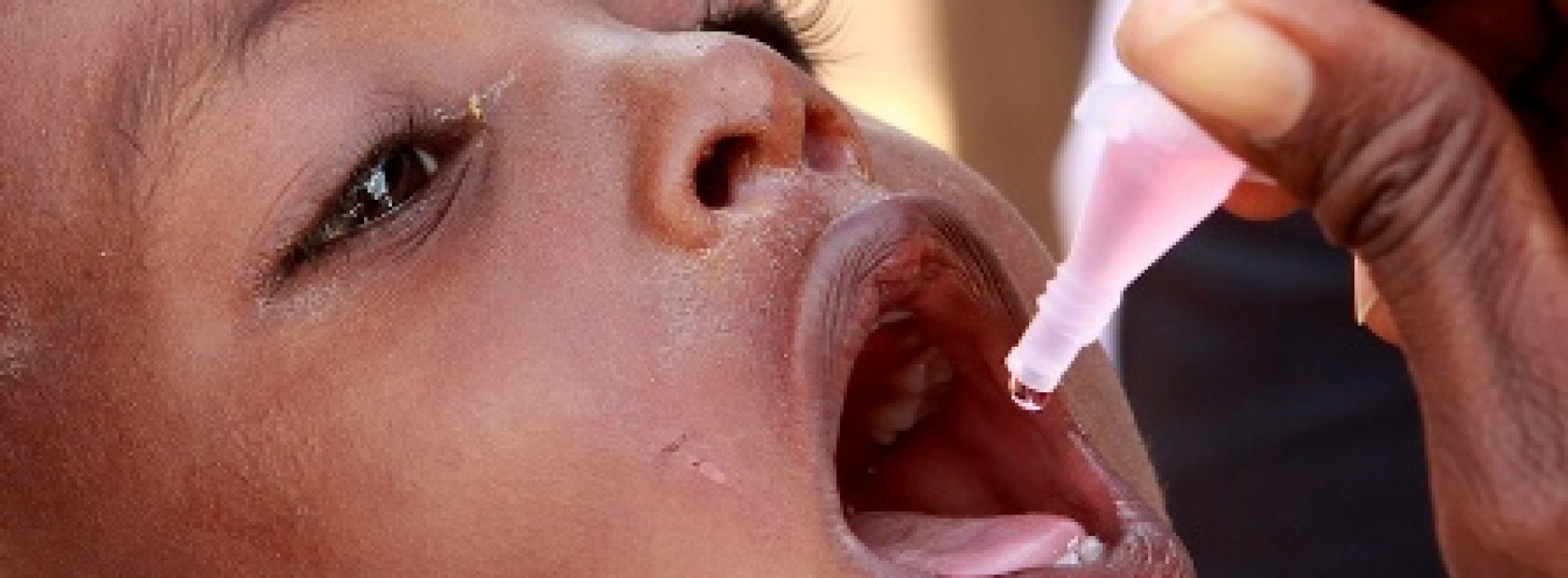 Worldwide switch to bivalent oral polio vaccine begins on Sunday