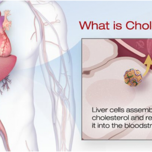 Measuring your Cholesterol