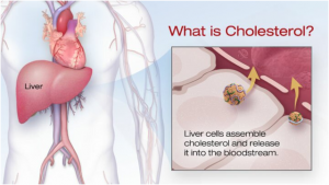 Cholesterol 1