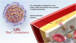 Cholesterol 2