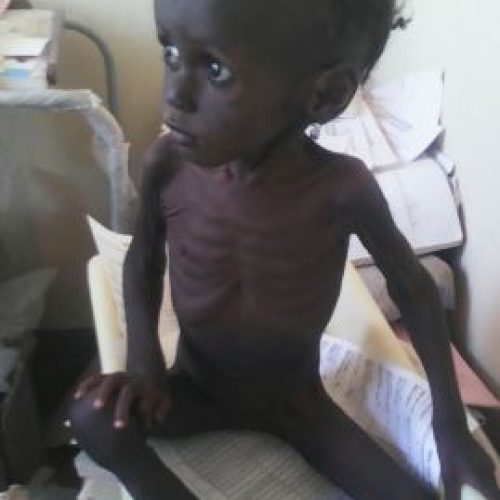 Nigeria’s malnutrition situation worsens