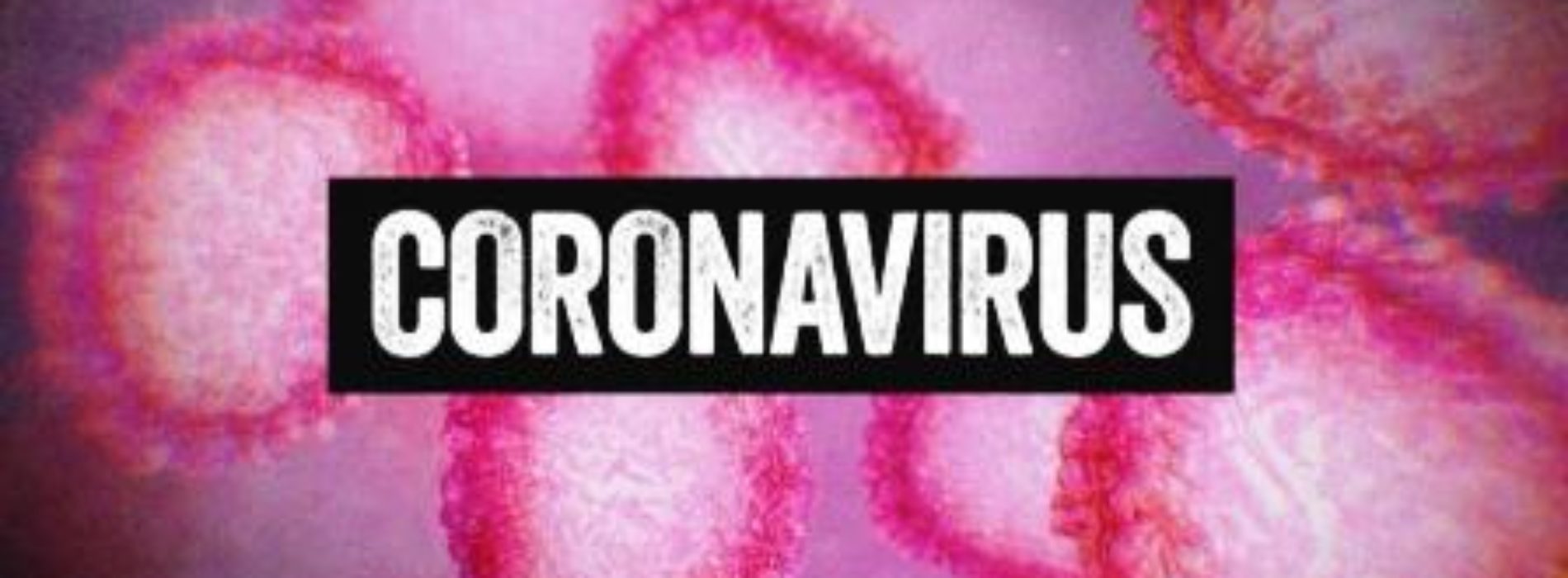Nigeria confirms first Coronavirus case