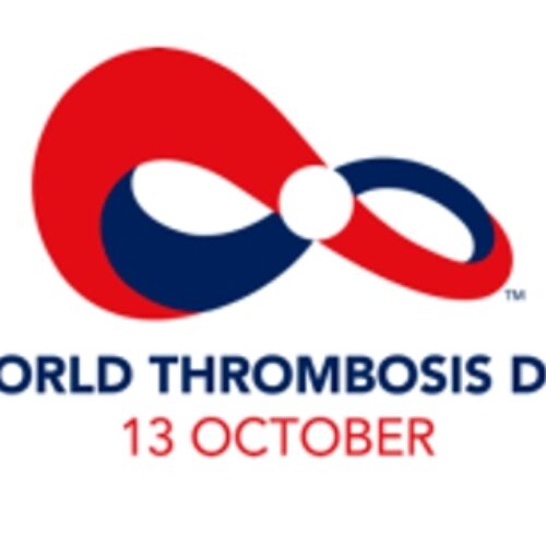 WTD: Death rate on thrombosis still high in Nigeria…Experts    