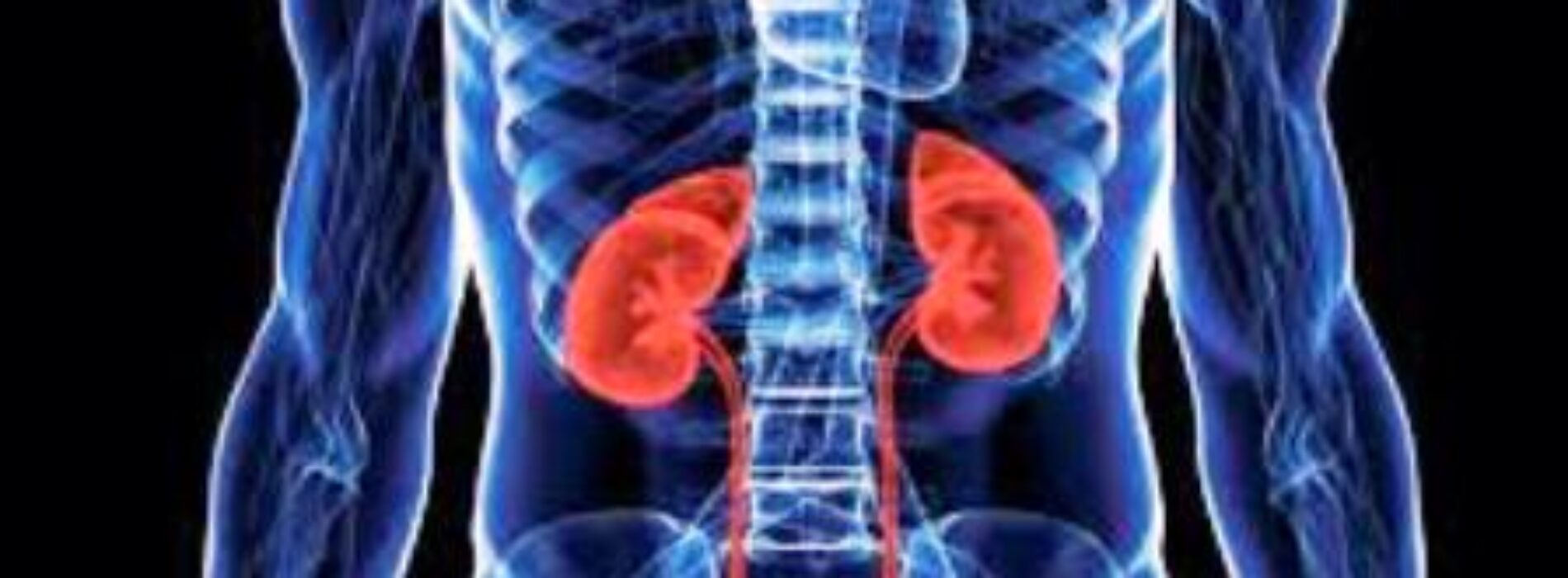 Kidney disease or anger of the gods?