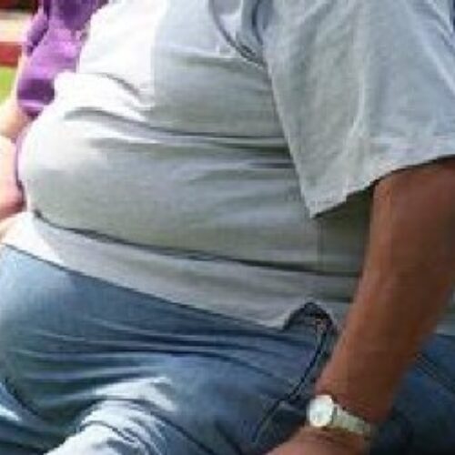 Obesity rising in Africa